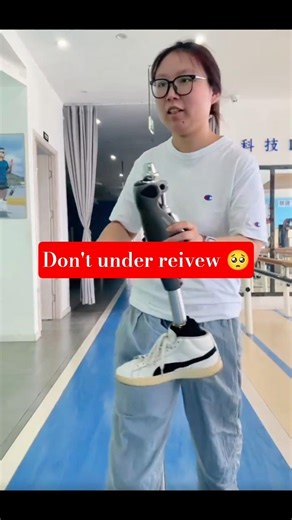 Amazing Prosthetic Leg Walking Skills | Real Life Prosthetic User