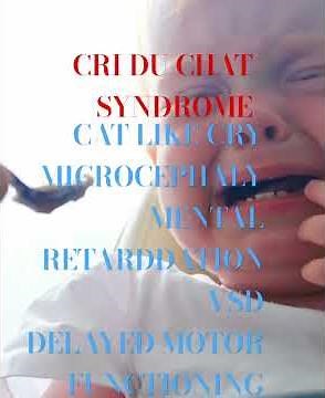 CRI DU CHAT SYNDROME