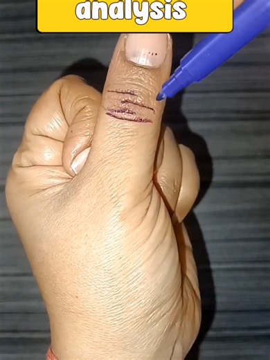 Understanding the Broken Thumb Line in Palmistry