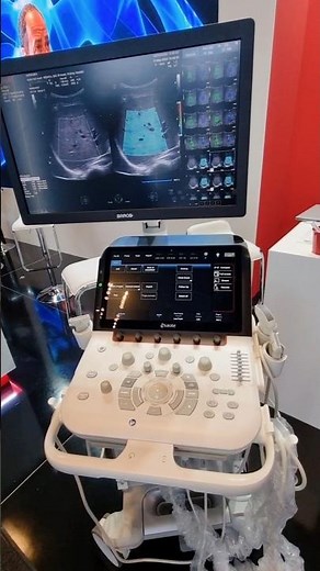 Dubai Healthcare Future Summit 2025: Esaote MyLab X90 Ultrasound System