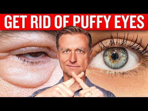Get Rid Of Puffy Eyes For Good With Dr. Berg's Proven Technique