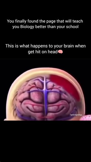 Explaining Biology on Instagram: "A hit to the head can affect the brain in several ways depending on how strong the impact is: 1. The brain can shake inside the skull The brain floats in fluid, so a sudden blow makes it move and bump against the skull. This can stretch or bruise brain tissue. 2. Temporary confusion (concussion) You may feel dizzy, see stars, get a headache, or feel confused for a short time. This is the most common effect of mild head injury. 3. Chemical imbalance The impact ca