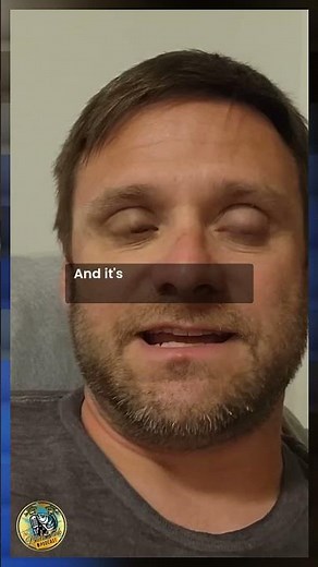 Why Florida Gets It Right in Preventing Snakehead Spread 🐍🌊