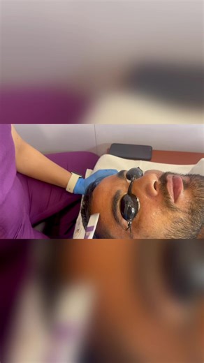 Glycolic acid peels are effective for removing blackheads, whiteheads, and pimples from skin. They also help to reduce pore size. Consistent and repeated use of glycolic acid peels have been shown to be effective for removing cystic lesions and acne scars #peels #glycolicpeel #chemicalpeel #ScarsTreatment #goodskincare | Anitas Makeover