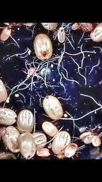 Removing Huge Ticks [Help Dog]