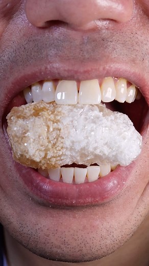 40K views · 112 reactions | ASMR | Freeze-Dried Cola Gummy 﫨 #DoctorTristanPeh #Dentist | Doctor Tristan Peh | Facebook