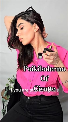 Neck Redness & Pigmentation Explained | IPL Treatment for Poikiloderma of Civatte