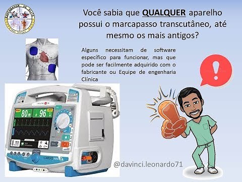 Marcapasso Transcutâneo (demonstração)