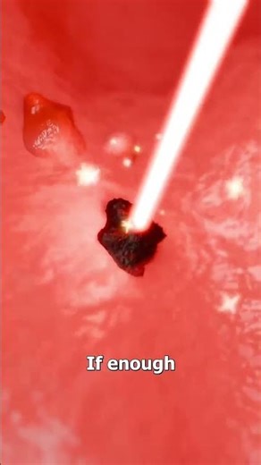 Fart during surgery 💨 #shortvideo #shorts #knowledge #education