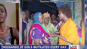 Former model: I was mutilated