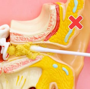 4.4K views · 37 reactions | Simple first aid hacks to help yourself in different situations! | 5-Minute MAGIC | Facebook