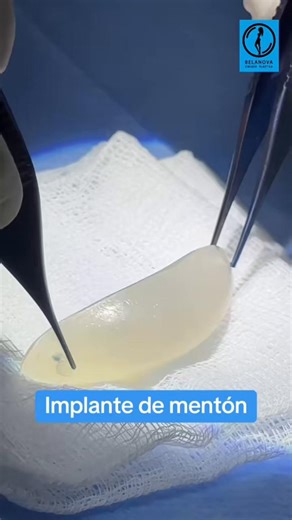 Implante de mentón ✨
