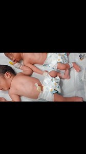 17K views · 260 reactions | Twins Newborn Baby Umbilical Cord Care &...
