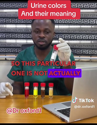 Understanding Different Urine Colors: What They Indicate