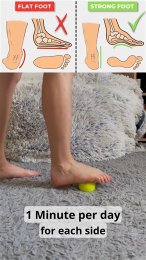 Flat foot exercises #viral #youtube