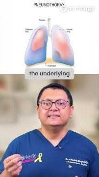 Catamenial pneumothorax = thoracic endometriosis. Endo + surgery cuts recurrence. #Endo #Health