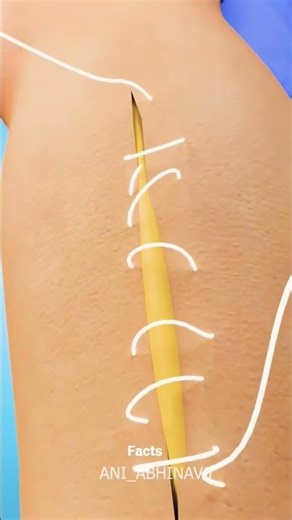 "How to Treat a Deep Cut at Home | First Aid Step by Step Guide" #epicfail