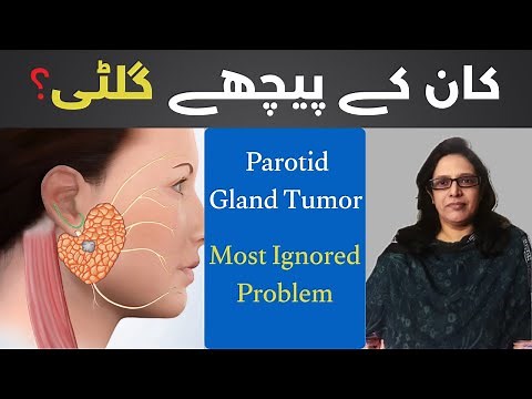 Parotid Gland Tumor Explained by Prof Dr Amna Javed