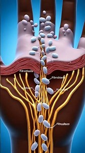 Watch Human Skin Heal and Stitches Dissolve in Real Time!