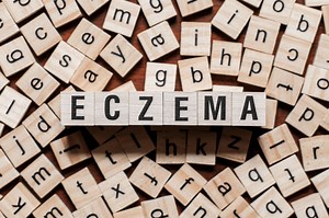9 Early Signs Of Baby Eczema, You Shouldn’t Avoid!