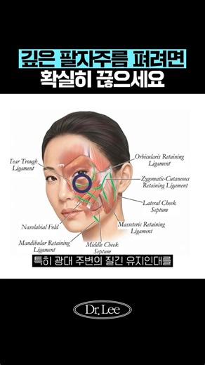Why Face-lifts Won't Fix Your Nasolabial Folds if You Only Pull the Surface: The Importance of Re...