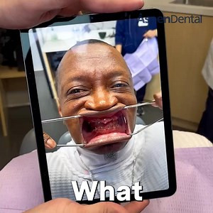 90 reactions · 11 comments | Considering dentures? Aspen Dental’s custom-fit dentures are made with durable materials & come with a 7-year warranty. | Aspen Dental | Facebook