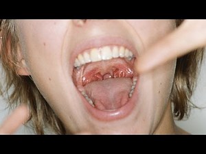 The 14 Worst Things People Have Put In Their Mouths