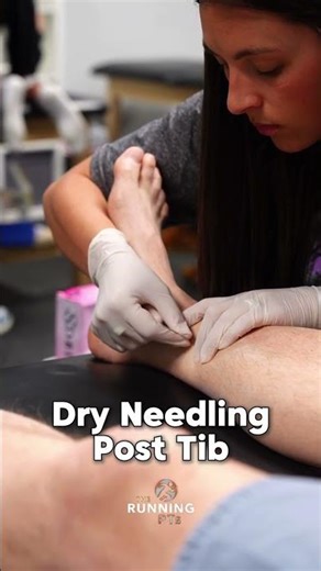 Dry Needling for Posterior Tibialis Pain