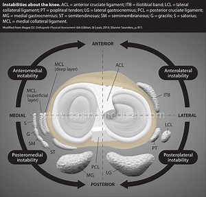 Knee PCL - Posterior Cruciate Ligament Injury and Treatments