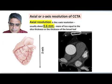 The accuracy of coronary CT angiography (CCTA) & statin regression trials