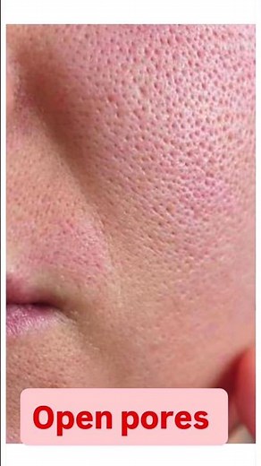 Best Retinol For Beginners | Best Anti-aging Cream | #doctorrajni #skincare #antiaging #retinol