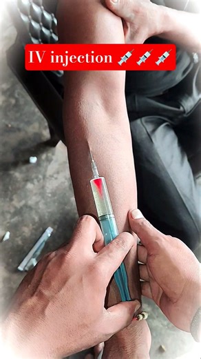 IV Injection लगाने का सही तरीका | Intravenous Injection Step by Step | Medical Tutorial in Hindi