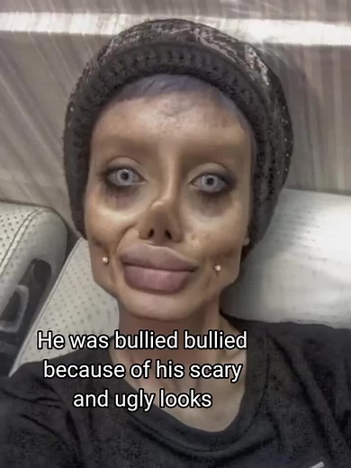 Sahar tabar the girl who took plastic surgery too far #fyp#foryou#edit