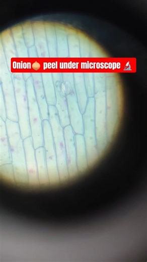 Onion Peel under microscope