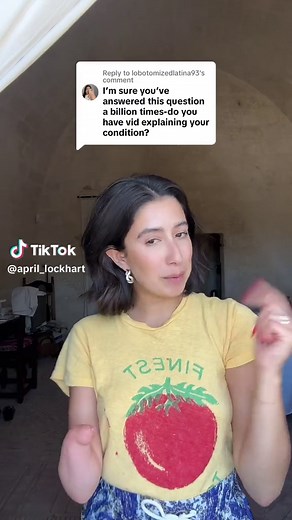 Understanding Amniotic Band Syndrome and Limb Differences