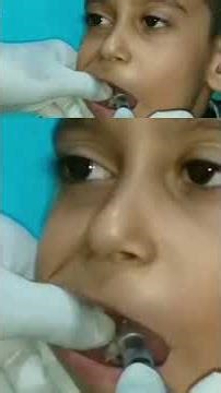 Inferior Alveolar Nerve Block in Children #ianb #atozkidsdental #toothisland