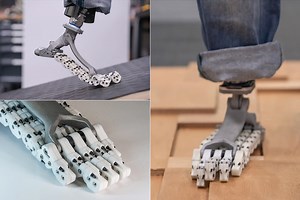 SoftFoot Pro is an Innovative Prosthesis That Mimics the Bones in a Real Human Foot