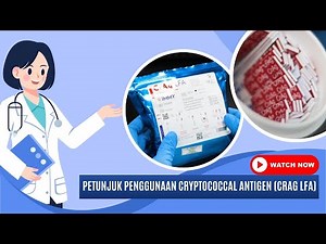 Video Tutorial Penggunaan Cryptococcal Antigen (CrAg LFA)
