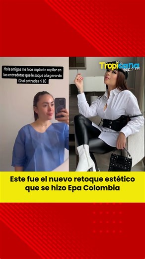 Este es el nuevo procedimiento estético que se hizo Epa Colombia en su cabello. En redes sociales mostró todos los detalles del antes y el después.🤯🤯😯👈🏻 #Tropicana #Bogotá #Tendencias #Famoso #EpaColombia #Pelo #Cirugia #Fyp #DianaCelis #Dafne #KarolSamantha