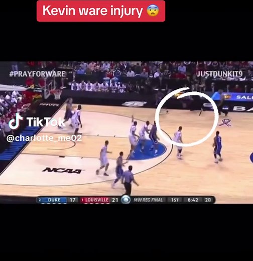 Kevin wares injury 😨😟#kevinware #basketballinjury #fyp #injury | kevin ware's now