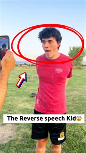 The Boy Who Speaks in Reverse 🤯 #shorts #ReverseSpeech #viralvideo #trending