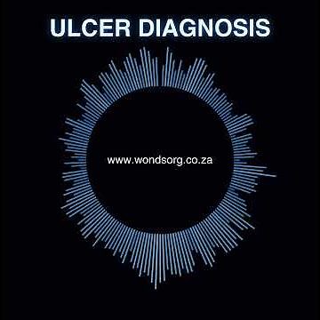 Ulcer Diagnosis