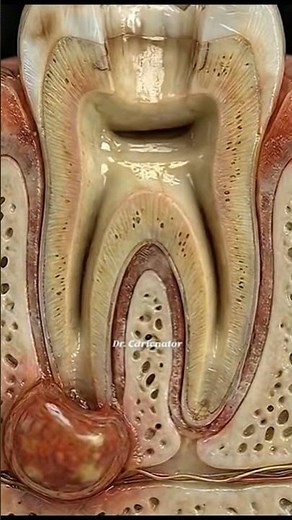 What Happens During a Root Canal? 🦷 Complete Process Explained | #toothcraft #asmr #satisfying
