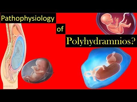 Pathophysiology of Polyhydramnios During Pregnancy