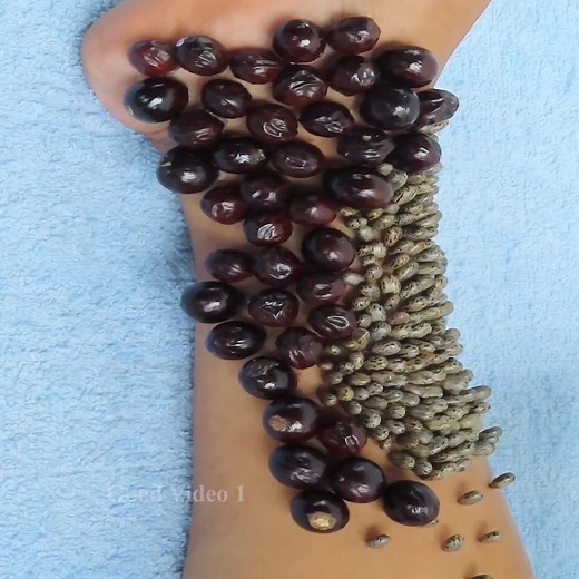 Removing and Picking a Ticks 2527 | Good video 1