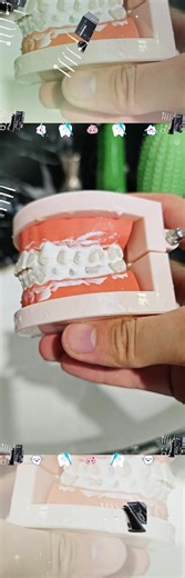 Experience Powerful Oral Care with This Water Flosser