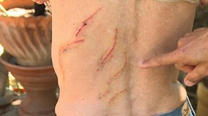 Woman survives bear attack in California