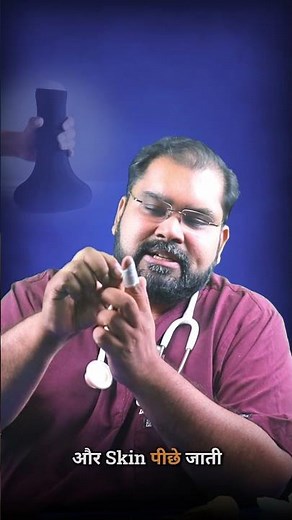 What Happens During PENIS Frenuloplasty?