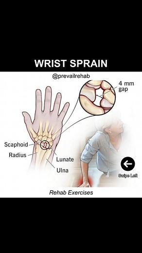 Wrist Sprain Rehab Exercises #physicaltherapy #rehab #wrist