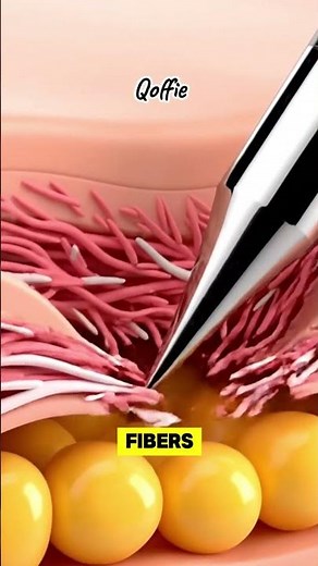 What Doctors Don't Want You to Know About Syringe Needle Technology